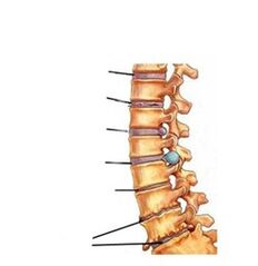 osteokondrosiaren garapenaren faseak